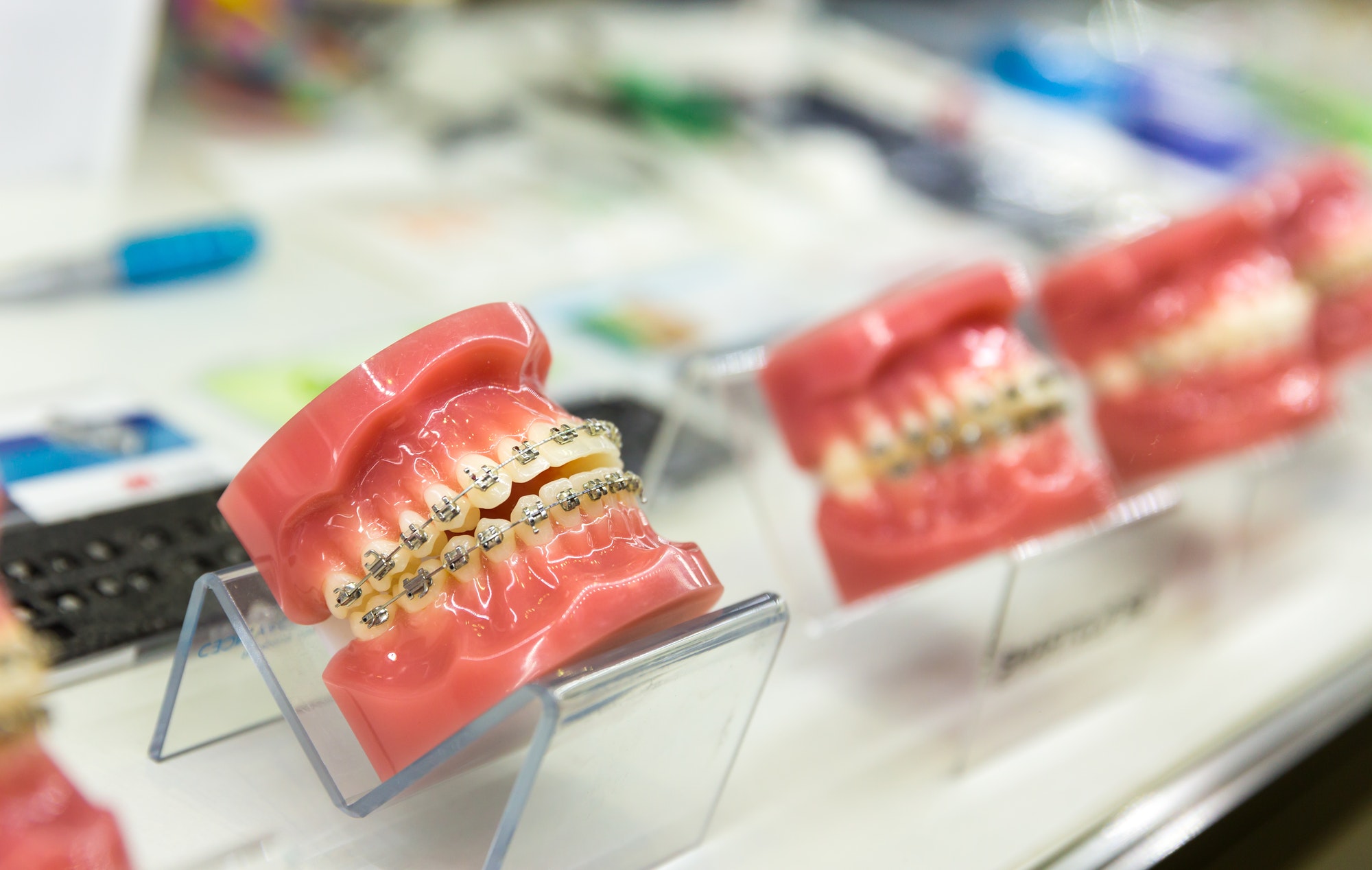 Orthodontic instruments and braces components laid out for treatment