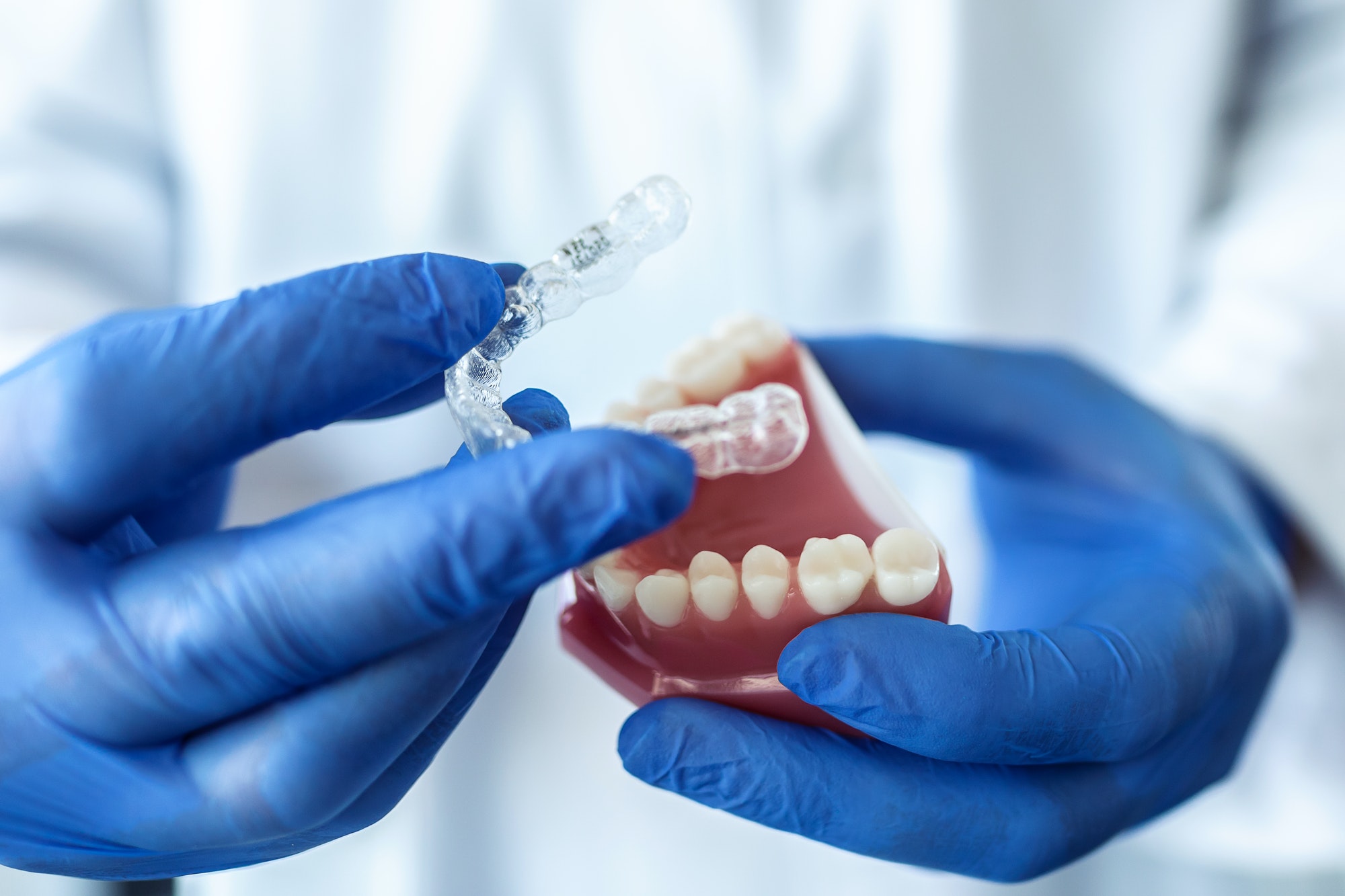 Model jaw fitted with clear aligners, held by a dentist