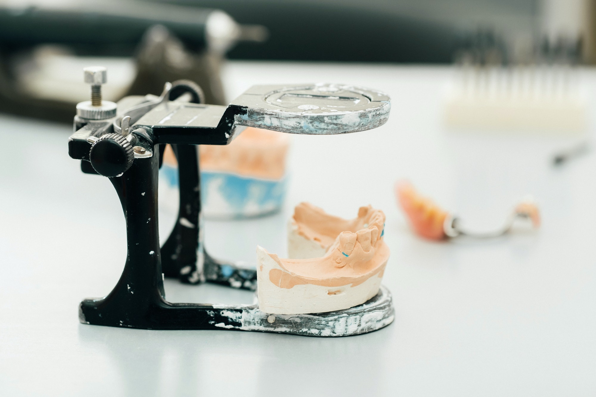 Plaster cast of a patient's jaw used to make dentures and crowns